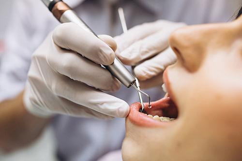 Do You Need to Buy a Dental Cover With Health Insurance? 